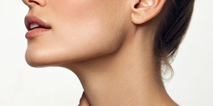 mentoplastia mentoplastia