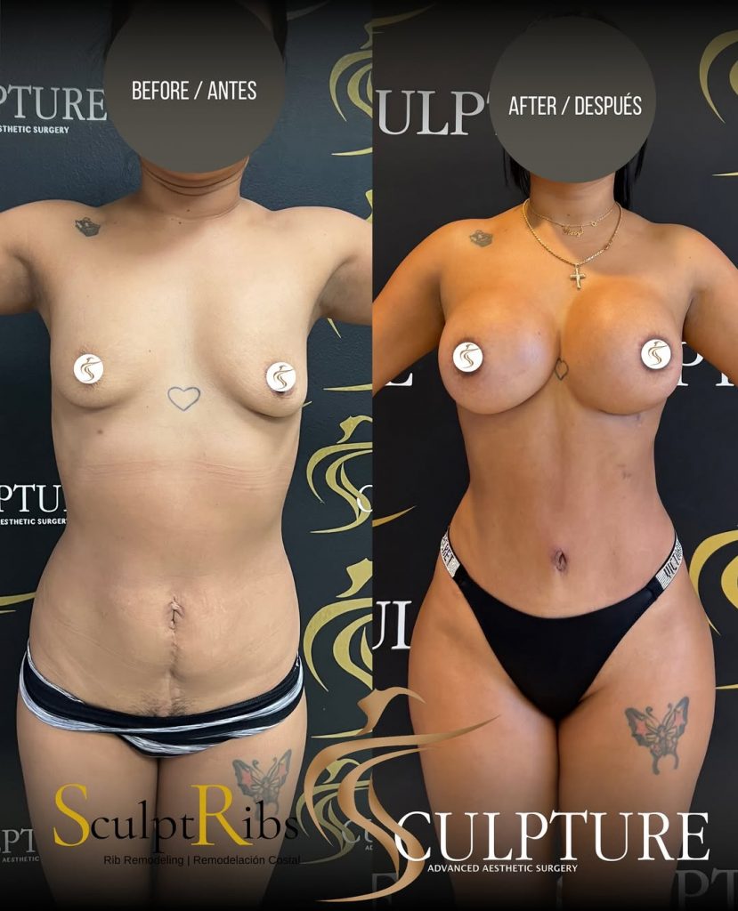 remodelacioncostal remodelacioncostal